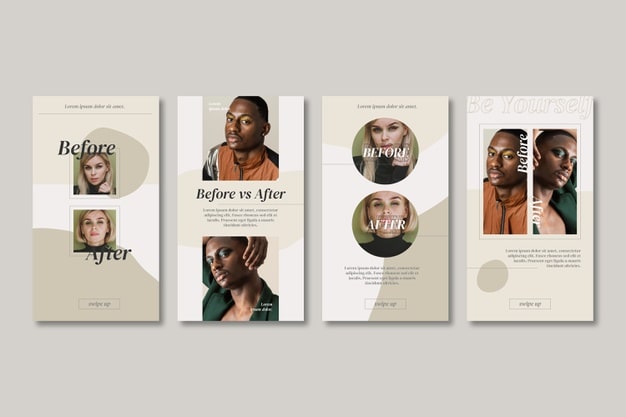 Free Vector before and after ig story collection