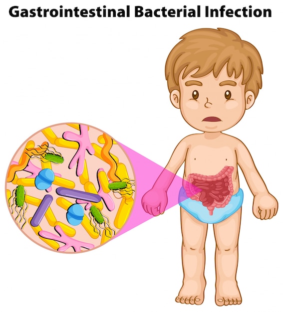 Free Vector boy and gastrointestinal bacterial infection