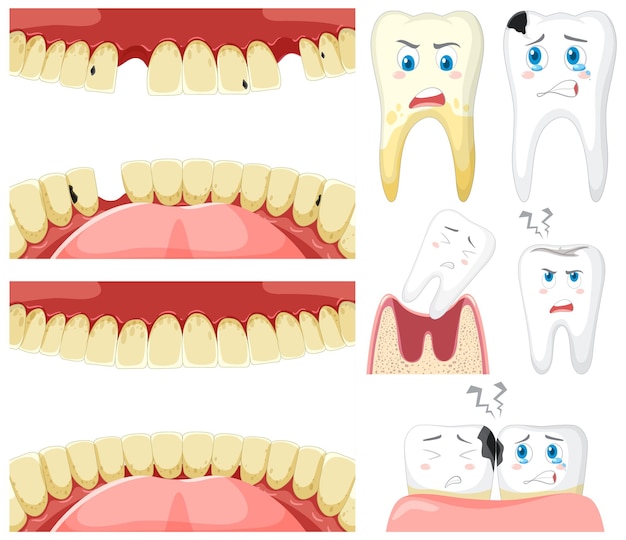 Free Vector set of all types of teeth on white background