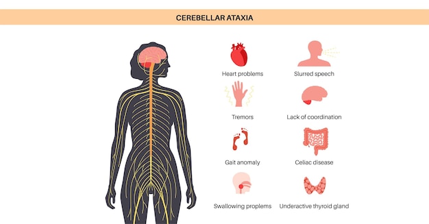 Vector ataxia cerebellar disorder